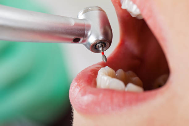 Best Emergency Dental Surgery in Hughestown, PA